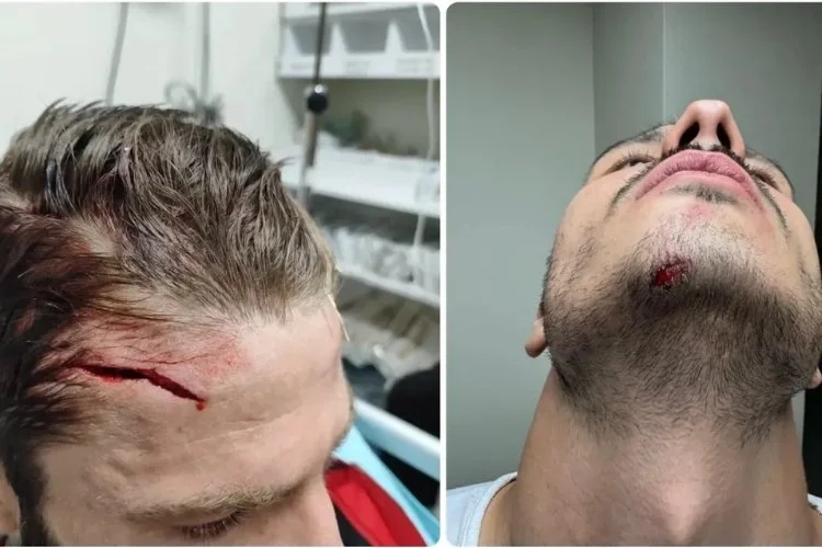 Beykoz Anadoluspor, Şanlıurfa temsilcisi Karaköprü Belediyespor’u 2-1 mağlup etti. Karaköprü