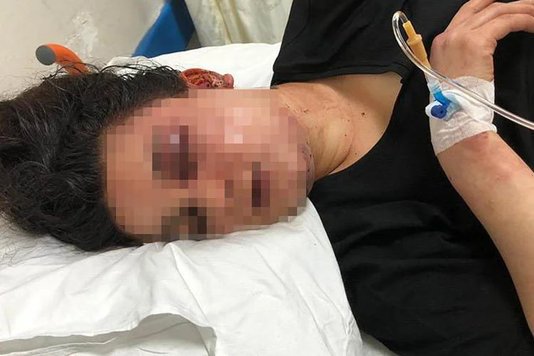 Boşanma safhasındaki eşi ve ailesi tarafından Beykoz ormanlarına kaçırılarak işkence