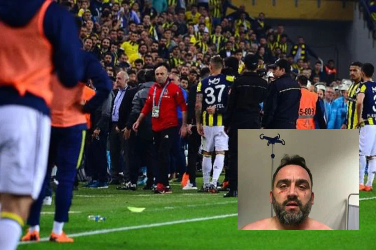 Beşiktaş – Fenerbahçe derbisinde çıkan olaylarda Beykozlu bir vatandaşta yaralandı.