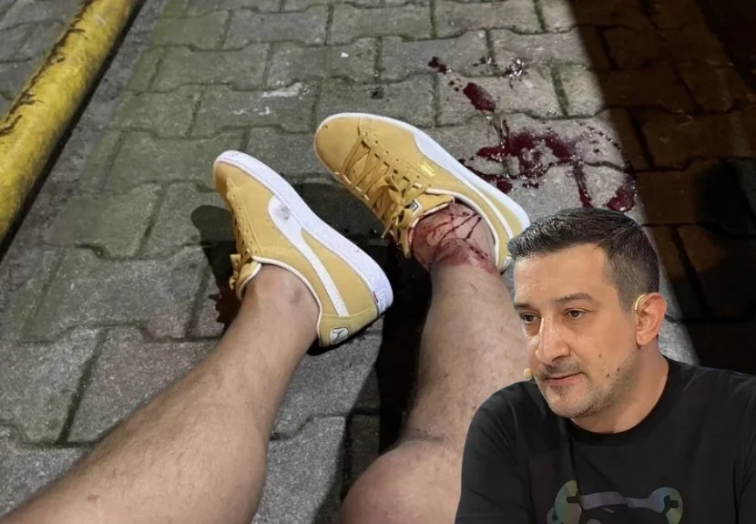 Eski Milli Futbolcu Serhat Akın'ın Beykoz Kavacık'ta silahlı saldırıya uğramasının