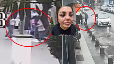 Beykoz Kavacık Mahallesi’nde tartışmalı olarak işten ayrılan S.K, saldırısına uğradığı